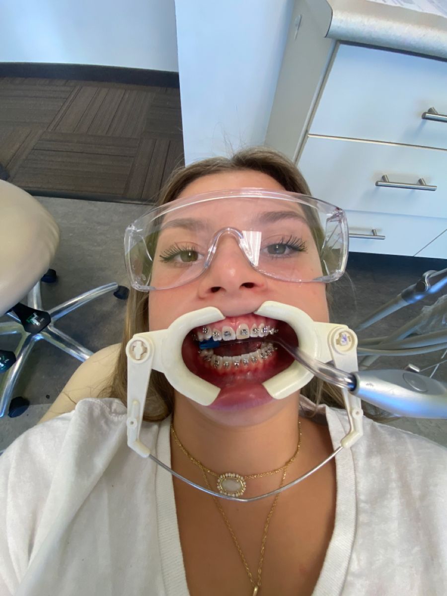 Dental Checkup with Braces