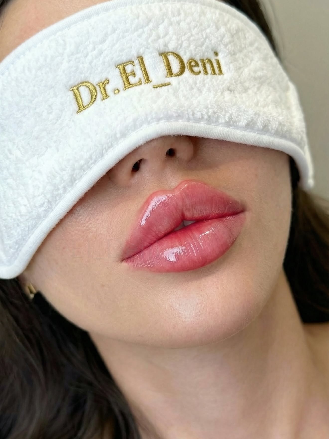 Glossy Lips with Eye Mask