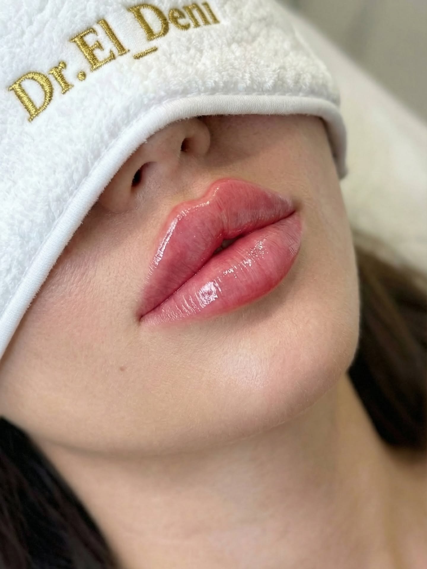 Glossy Lips Close-Up