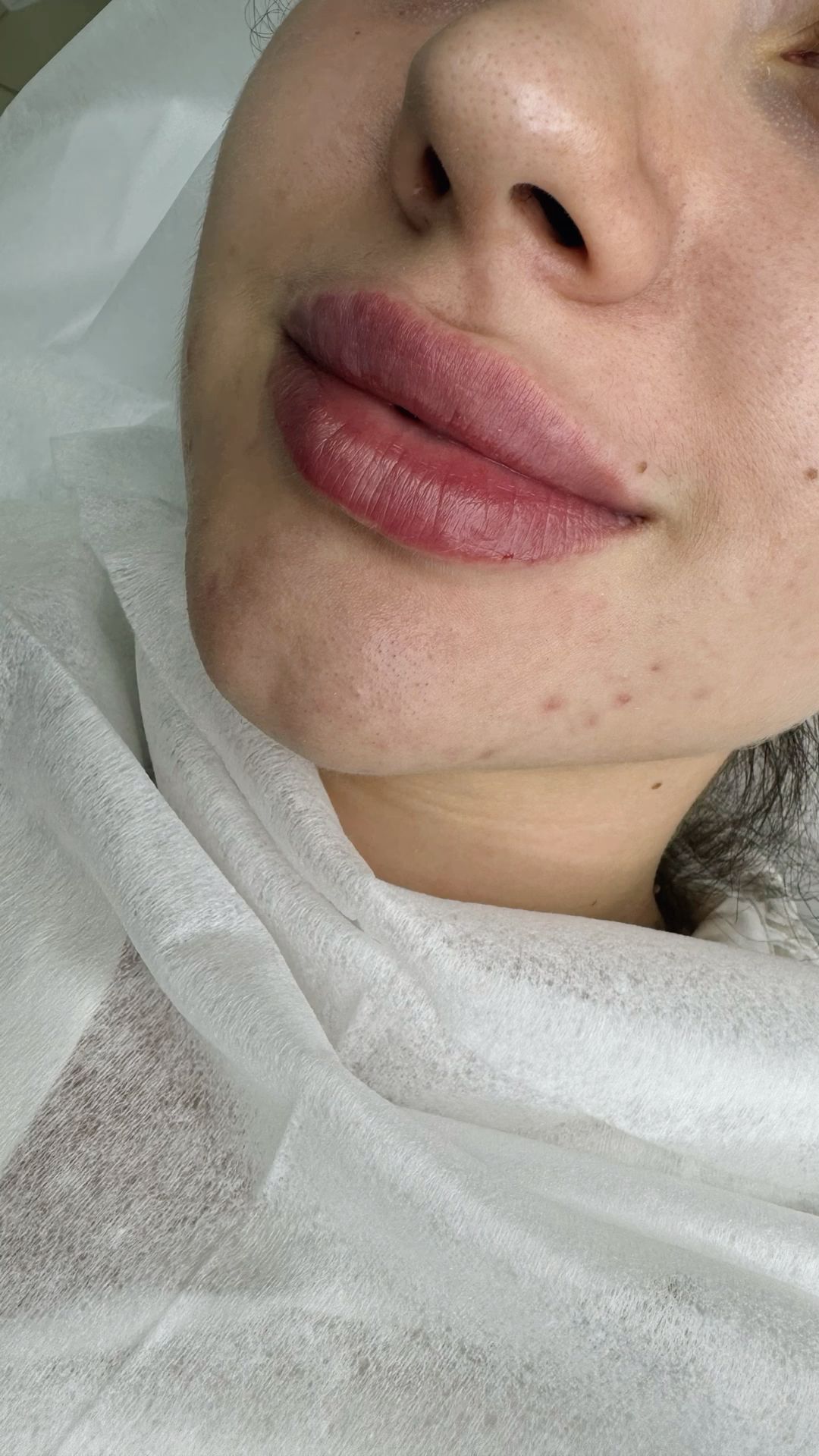 Close-up of Lips and Nose