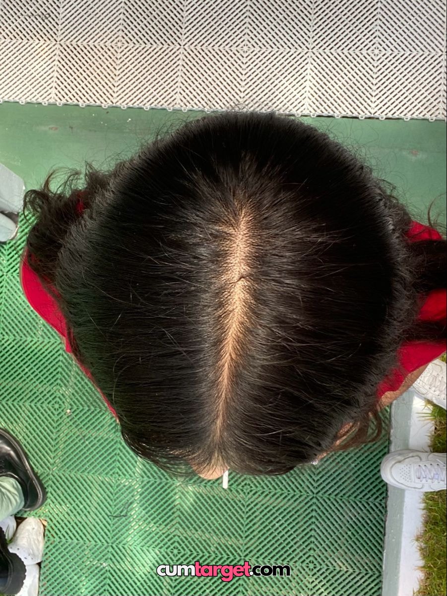 Spray on Spray on Top View of Person's Head