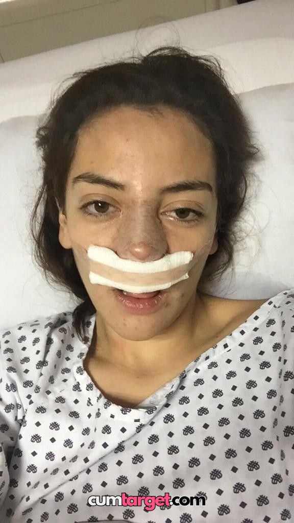 Cum target Spray on Patient Recovering in Hospital Bed